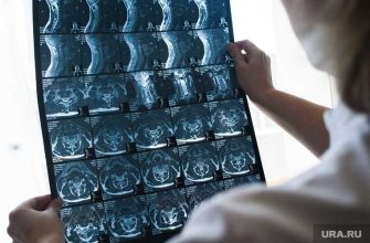 курс терапии рак