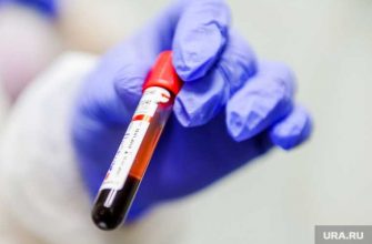 ксп коркинский район крымский